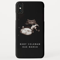 Pregnancy Baby Sonogram Ultrasound Photo