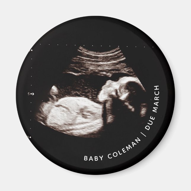Pregnancy Baby Sonogram Ultrasound Photo Magnet (Front)
