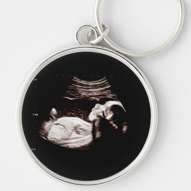 Pregnancy Baby Sonogram Ultrasound Photo New Mom Keychain (Front)
