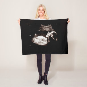 Pregnancy Keepsake Baby Ultrasound Sonogram Photo Fleece Blanket