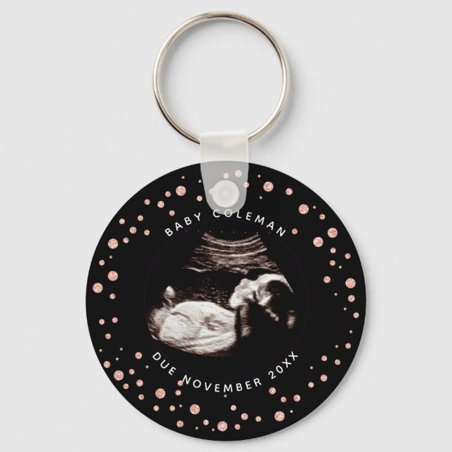 Pregnancy Pink Glitter Sonogram Ultrasound Photo Keychain (Front)