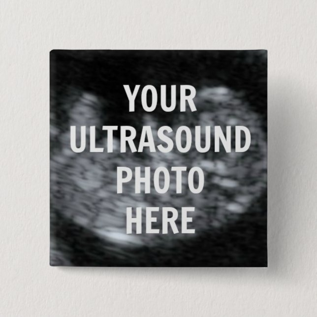Pregnancy Ultrasound Keepsake 2 Inch Square Button (Front)