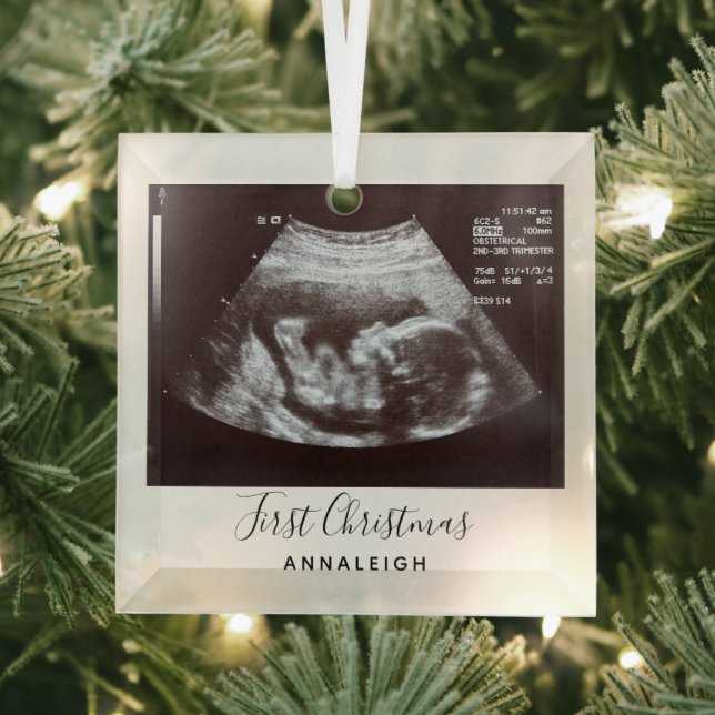 Pregnancy Ultrasound Photo First Christmas Holiday Glass Ornament (Insitu)