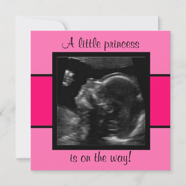 Princess Baby Customized Ultrasound Photo Template (Front)