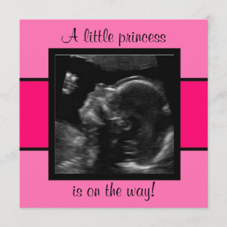 Princess Baby Customized Ultrasound Photo Template