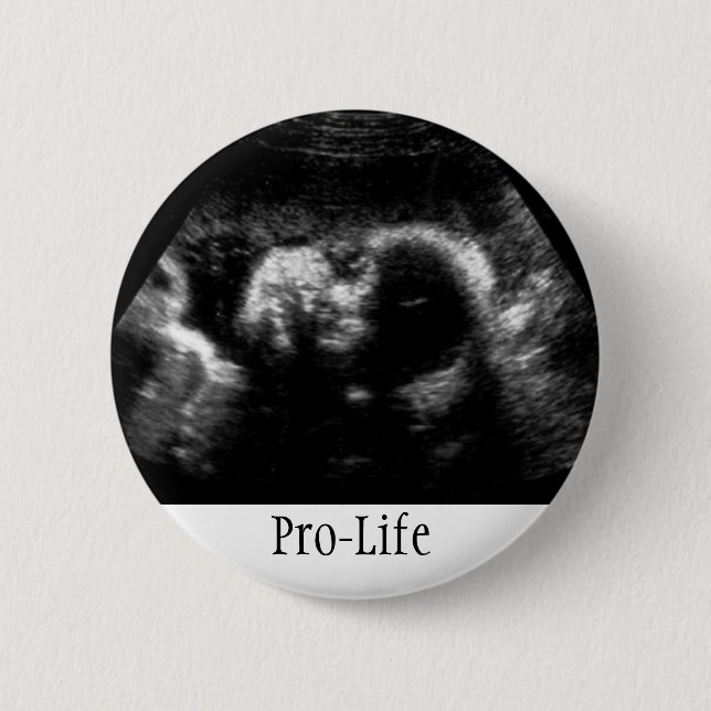 Pro-Life 2 Inch Round Button (Front)