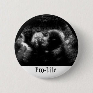 Pro-Life 2 Inch Round Button