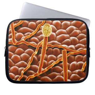 Protection Pour Ordinateur Portable Champignon de rouille pulvérulente sur la