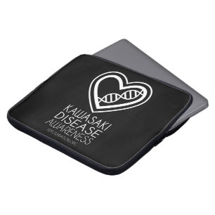 Protection Pour Ordinateur Portable Douille d'ordinateur portable de KD