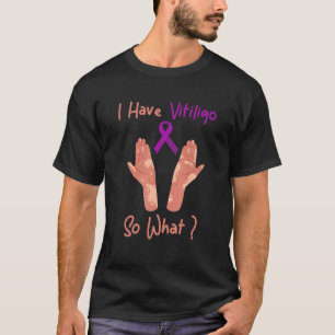 Purple Awareness Ribbon I Have Vitiligo So What T-Shirt