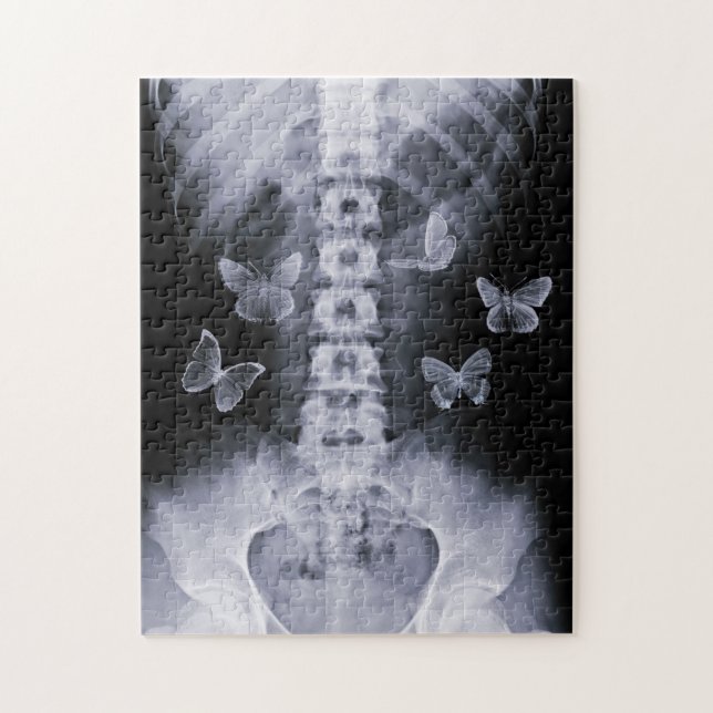 Puzzle conceptuel de papillons de rayon X (Vertical)
