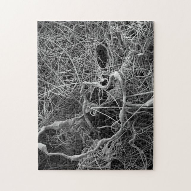 Puzzle de sac à oeufs d'araignée (Vertical)