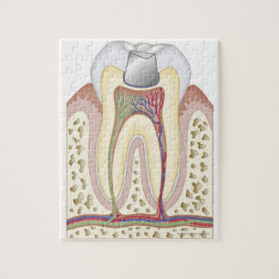 Puzzle Illustration du remplissage dentaire