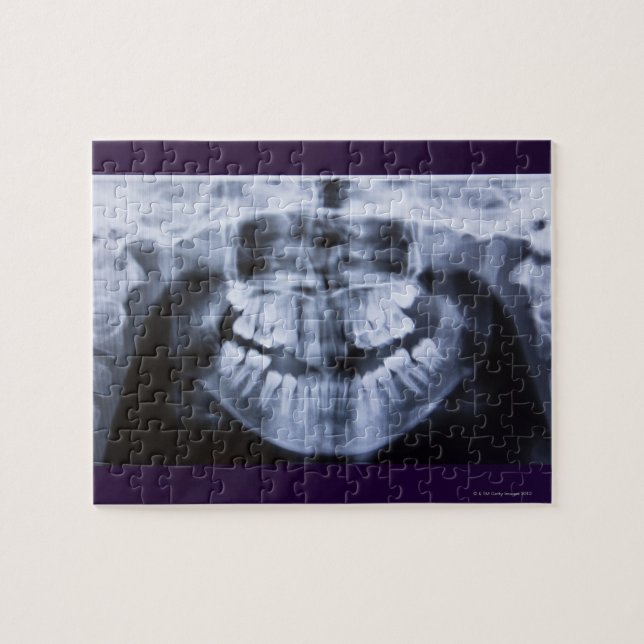 Puzzle Xray d'une mâchoire fillette prise avec le panoram (Horizontal)