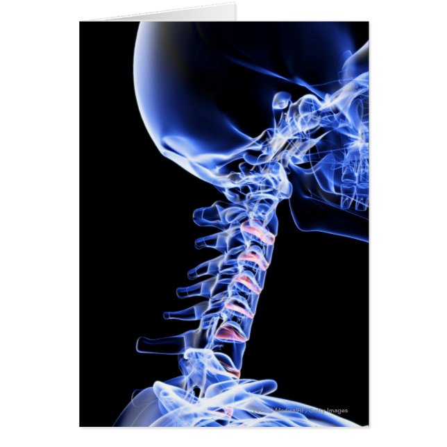 Radiographiez l'image des os du cou (Devant)