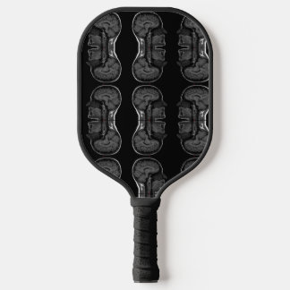Raquette De Pickleball im dans votre tête xray mri scanner médical