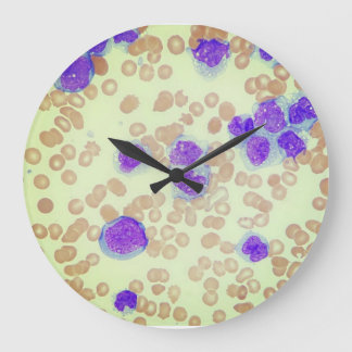 RBCs WBCs Slide Microscope Hematology Lab Large Clock