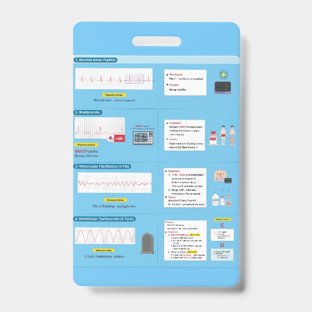 Référence rapide du badge EKG (Avant)