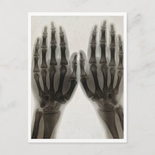 Reproduction de carte postale médicale vintage de