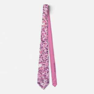 Retinocytoma: Fleurettes Tie