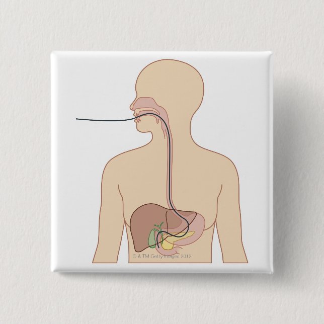 Route of Endoscope 2 Inch Square Button (Front)