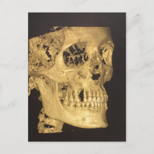 Scary Skull Postcard
