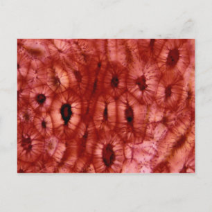 Sclerenchyma Cells from a Cherry Pit Postcard
