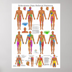 Sclérotome Douleur articulaire Poster Chiropratiqu