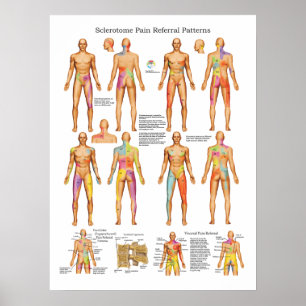 Sclerotome Visceral Pain Poster de référence