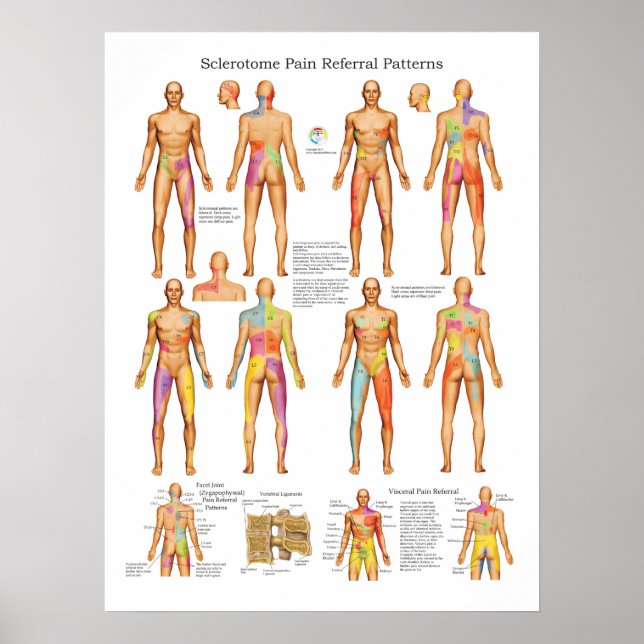 Sclerotome Visceral Pain Poster de référence (Devant)