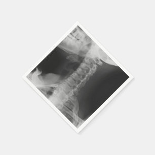 Serviettes Jetables 2 radiographiés (original)