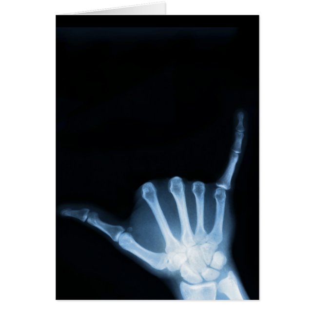 Shaka Sign X-Ray (Hang Loose) (Front)