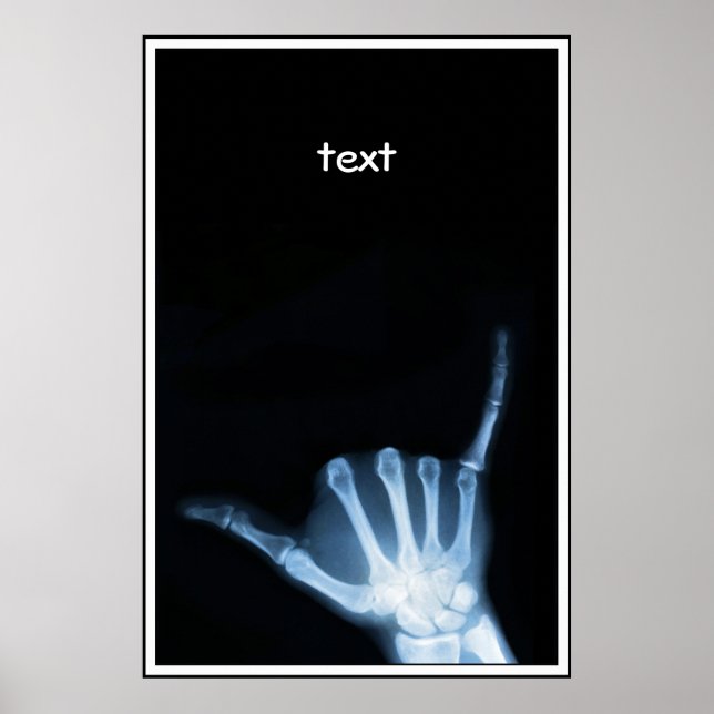 Shaka Sign X-Ray (Hang Loose) (Front)