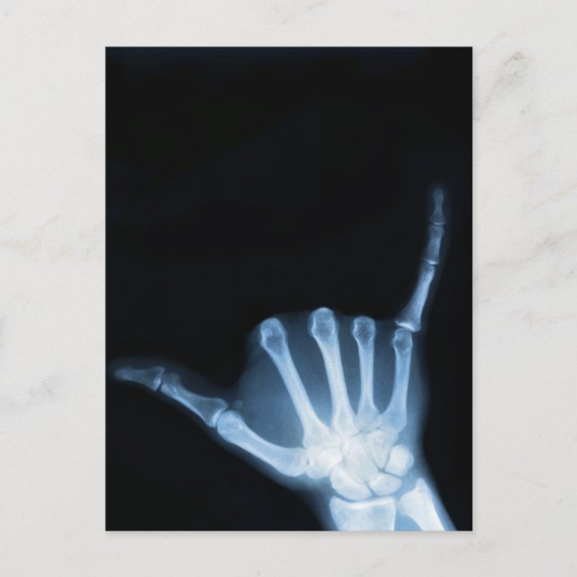 Shaka Sign X-Ray (Hang Loose) Postcard (Front)