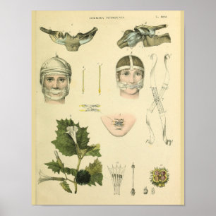 Shoulder Joint Clavicle Anatomy Art Vintage Print