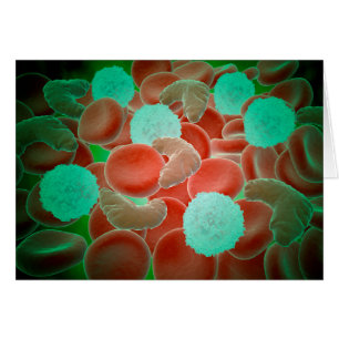 Sickle Cell Anemia With Red Blood Cells