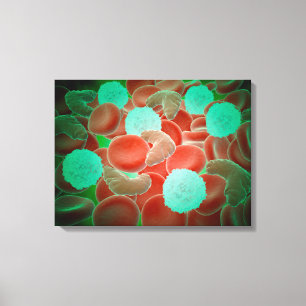 Sickle Cell Anemia With Red Blood Cells Canvas Print