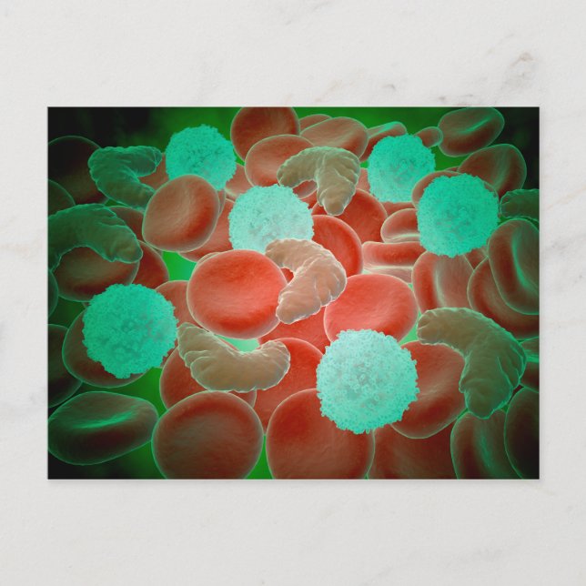 Sickle Cell Anemia With Red Blood Cells Postcard (Front)