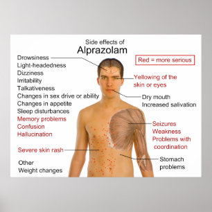 Side Effects Chart for the Drug Alprazolam