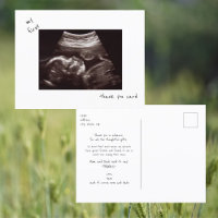 Simple Funny Ultrasound Baby Shower Thank You