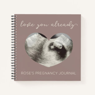 Simple Heart Sonogram Ultrasound Pregnancy Journal