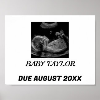 SIMPLE& SWEET: BABY ANNOUNCEMENT POSTER