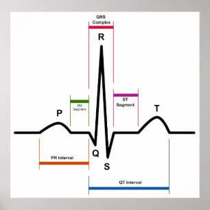 Sinus Rhythm in an Electrocardiogram ECG Diagram Poster