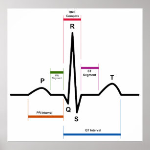 Sinus Rhythm in an Electrocardiogram ECG Diagram Poster