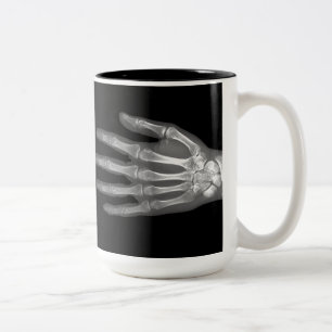 Skeleton Hand X-Ray Two-Tone Coffee Mug
