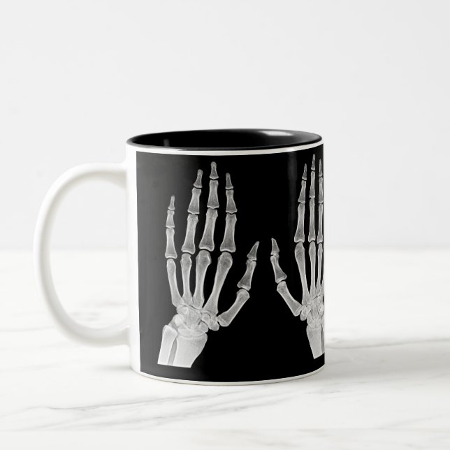 Skeleton Hands Xray Picture Human Anatomy photo Two-Tone Coffee Mug (Left)