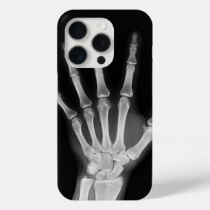 Skeleton iPhone 15 pro cover