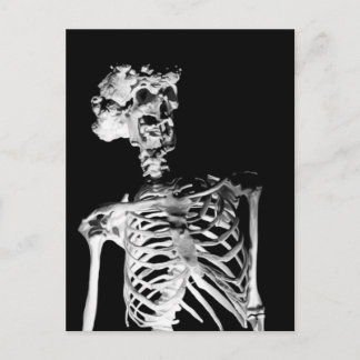 Skeleton Postcard