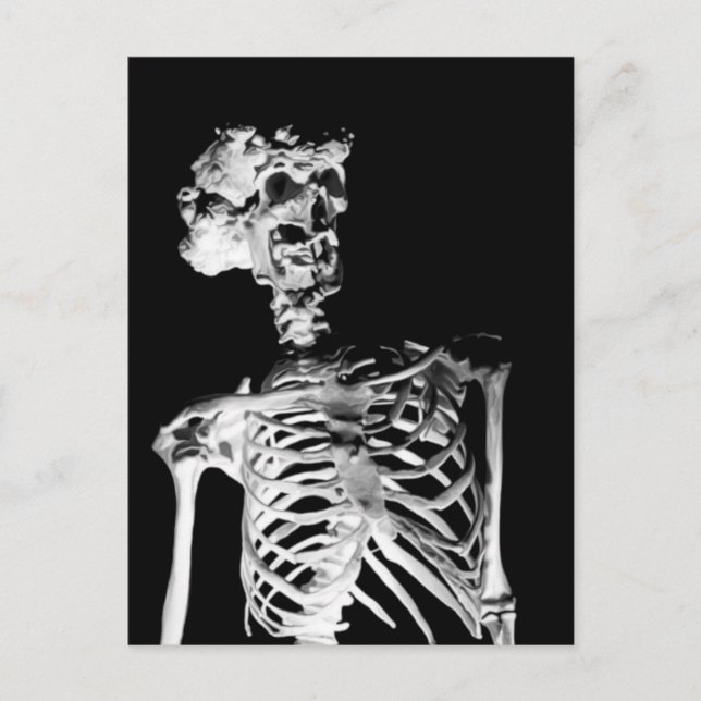 Skeleton Postcard (Front)
