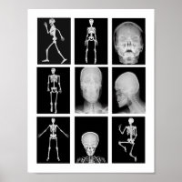 skeleton Skull Human Body XRAYS Collage art